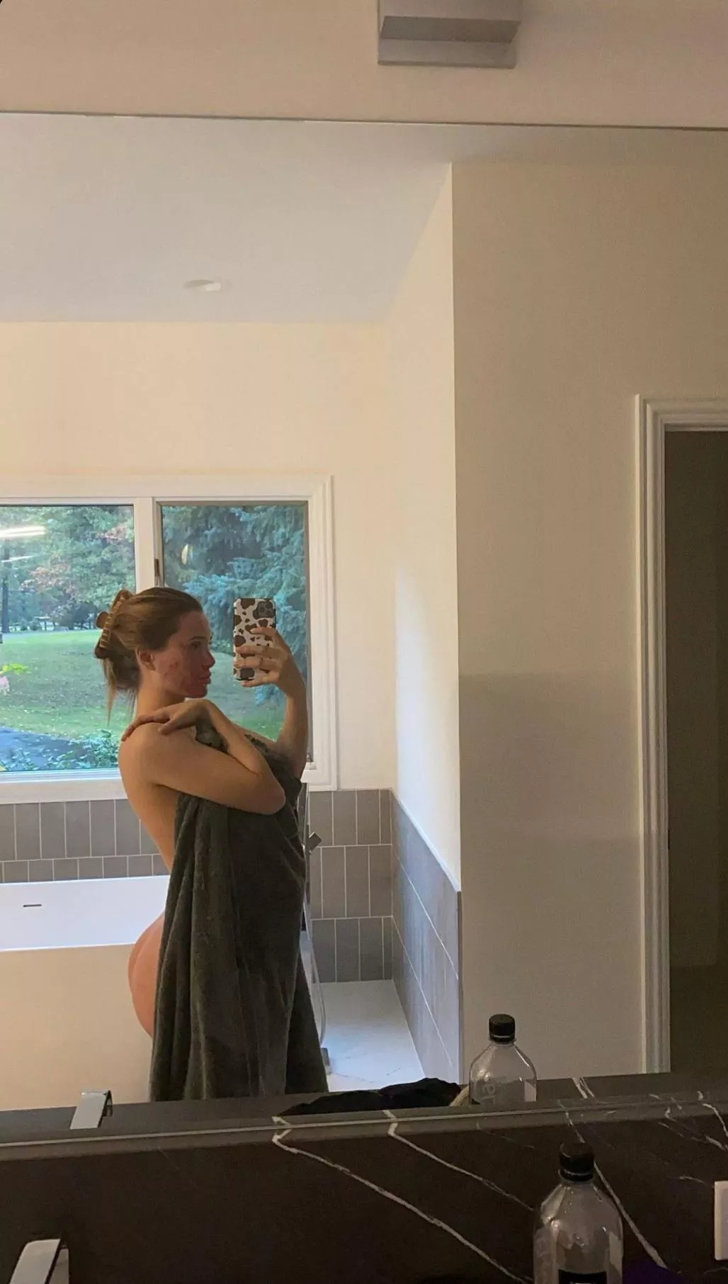 What happened to her face posted by pranil58