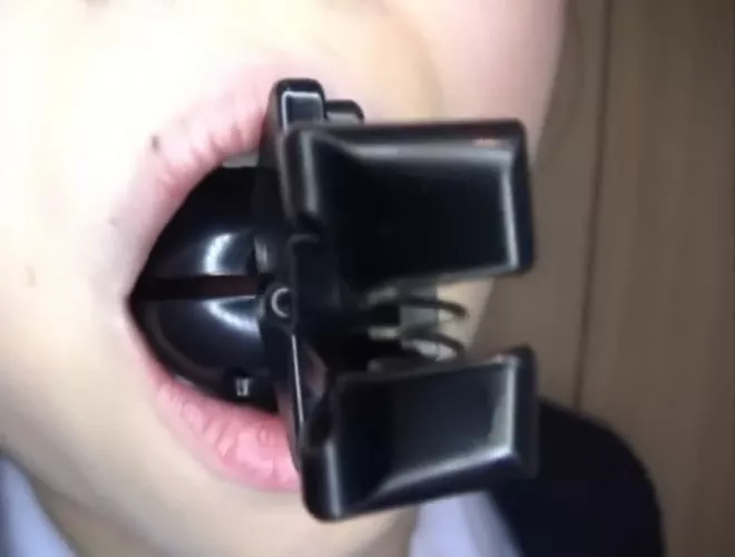 What is this 'gag'? by NeoIcecream