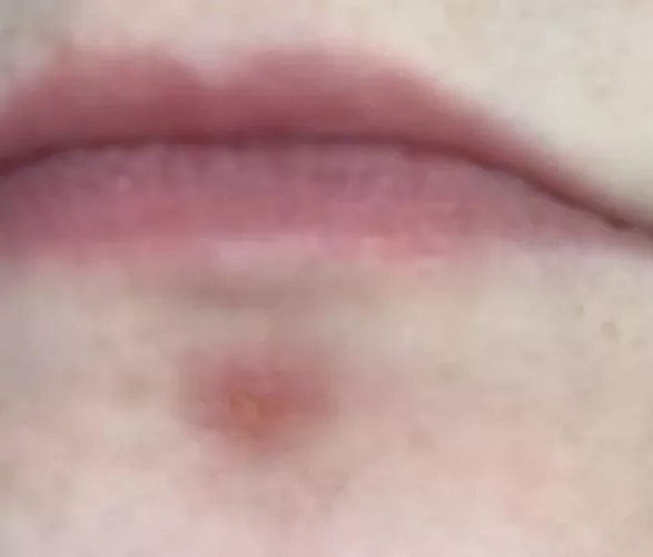 What is this? It hurts like a bitch and its hard. by imblueladadeeladadoo