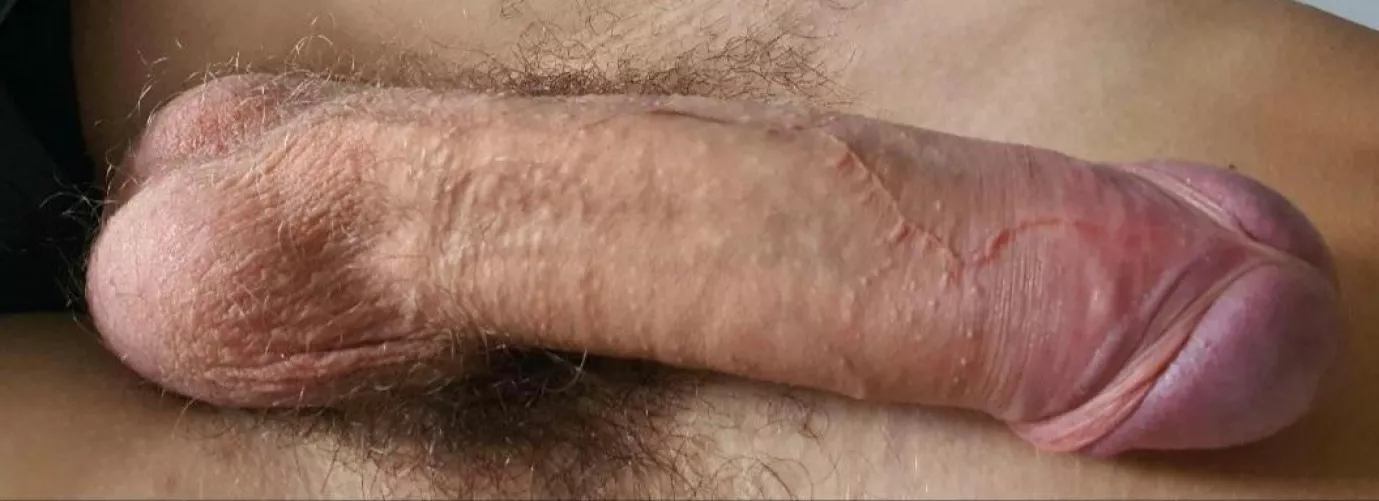 Whatsupp by Previous_Part4572