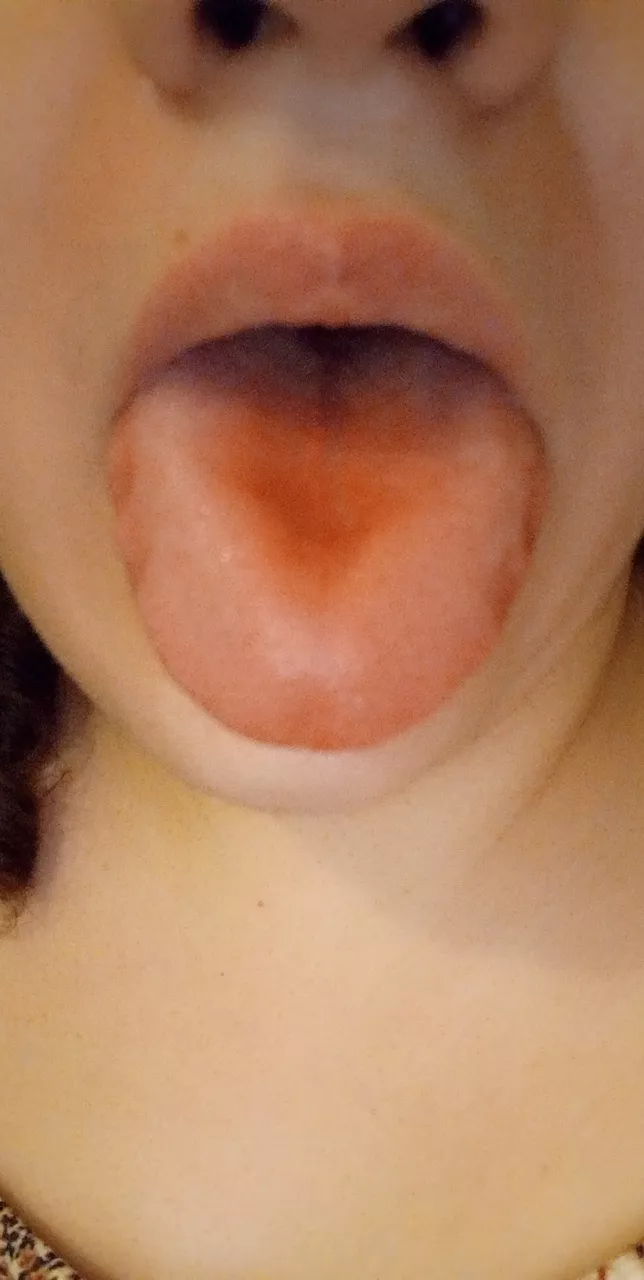 When candy stains your tongue red 🍬 🍓It's the Little things 🥰 posted by SevereHawk6818