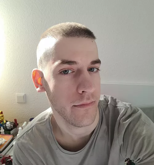 When every last bit of your acne is gone and you realize you have great skin now by Jackfruit93