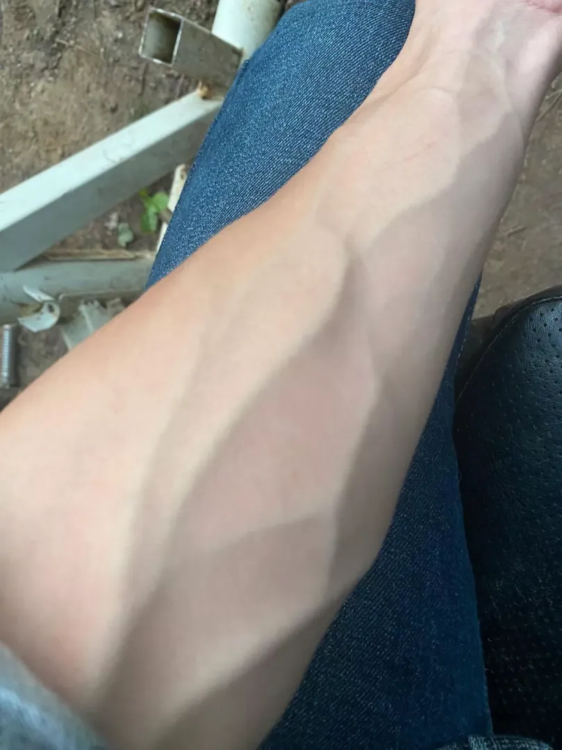 When I was still deathly pale haha posted by WeenerSecret