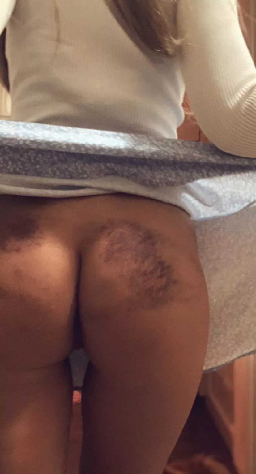 When man hits me, it’s because they likes me. Right? [F] posted by myropesbunny