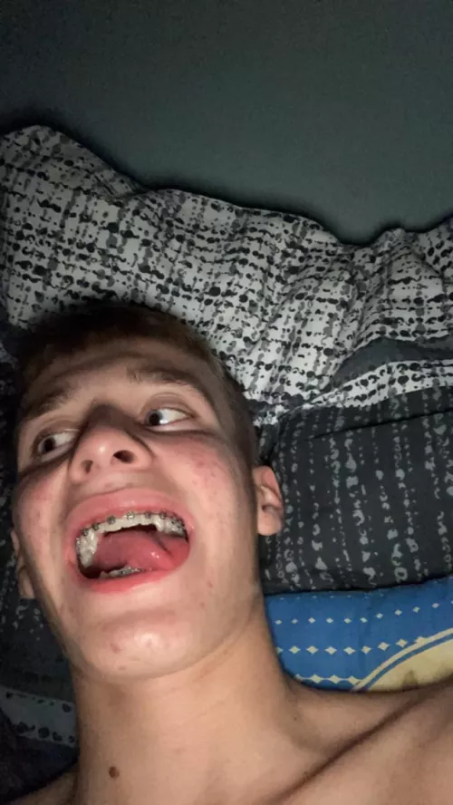 Who likes braces?💦 by Cuumtrbn