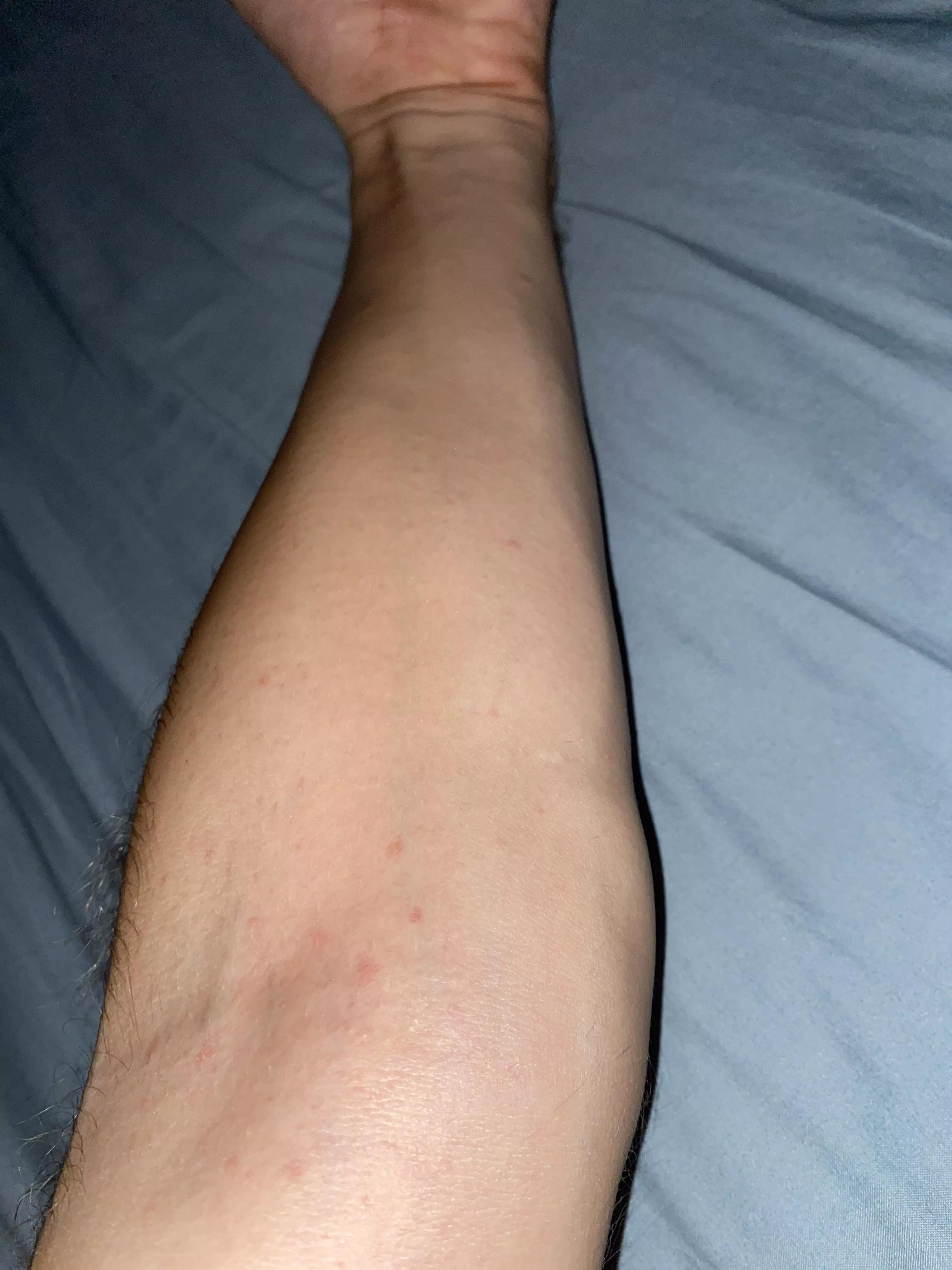 Who wants lick my smooth and juicy forearm?😏 posted by afklejsj