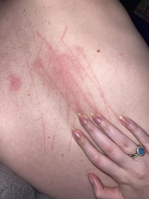 Who wants me to scratch them!! 😈💋 by littlecanvases