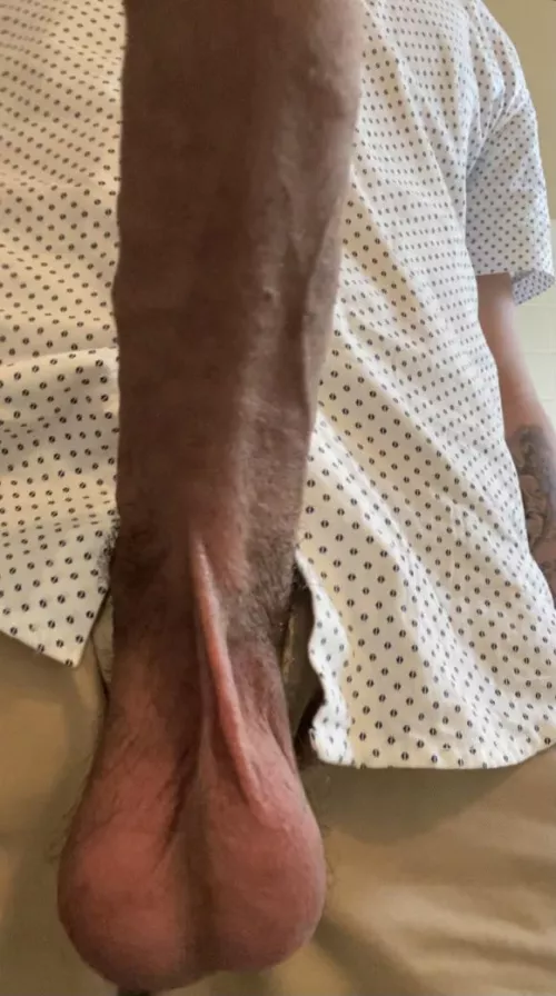 Who wants to suck em? by Outrageous-Star-7178