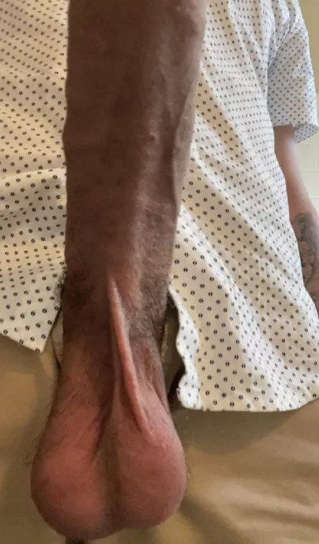 Who wants to suck em? by Outrageous-Star-7178