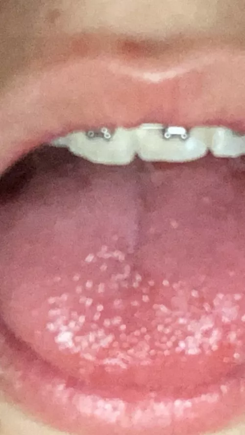 Who would cum on my brackets 🤝 by cumfoodtrh