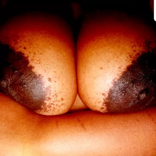 Who's up?! by Hersheykiss715