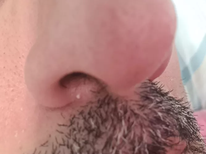 Why this little spot hurts so much 😫😫 I'm not afraid to pop it... but hurts only to touch it. by carloscarlusik