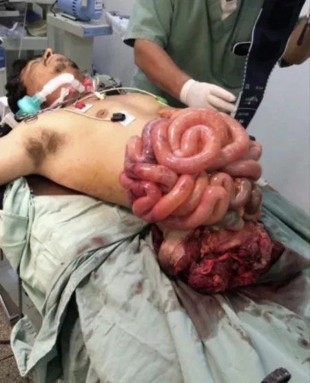 Why woodchippers are scary as hell by KISSfanFOXV2