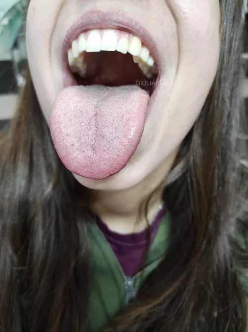 Wide open for you by giuliapeach