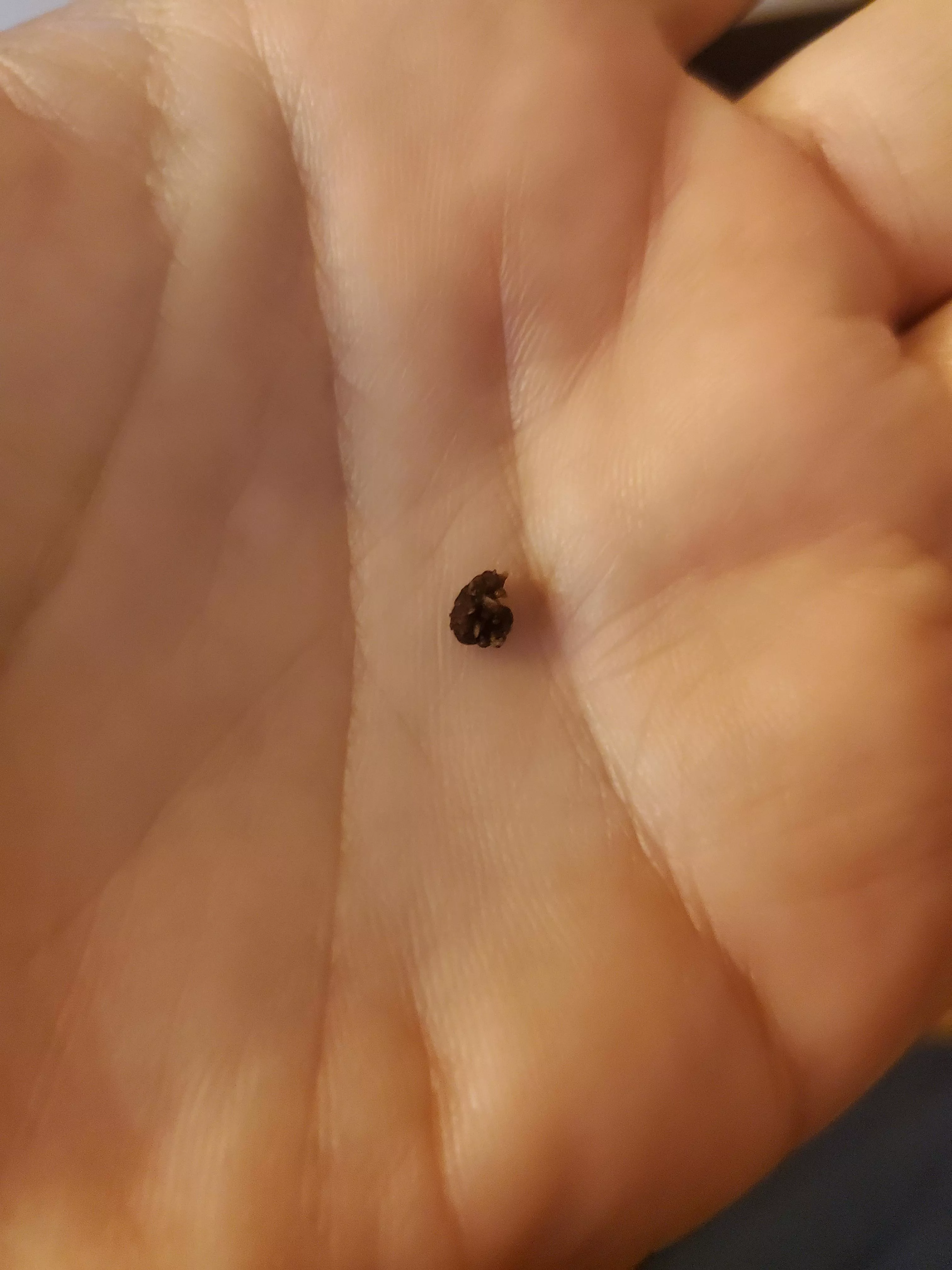 Wife popped this kidney stone out. Zoom in to see it's evil spikes posted by jaxpaboo