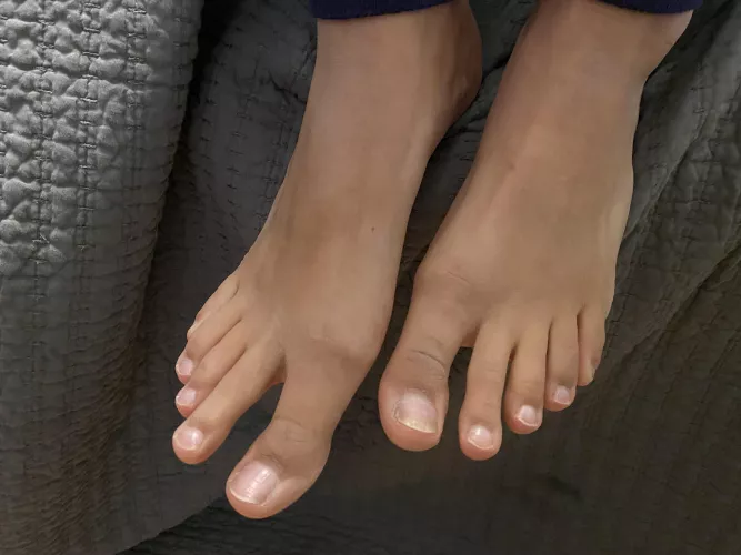 Will anyone rub my feet? by hapa_wawae