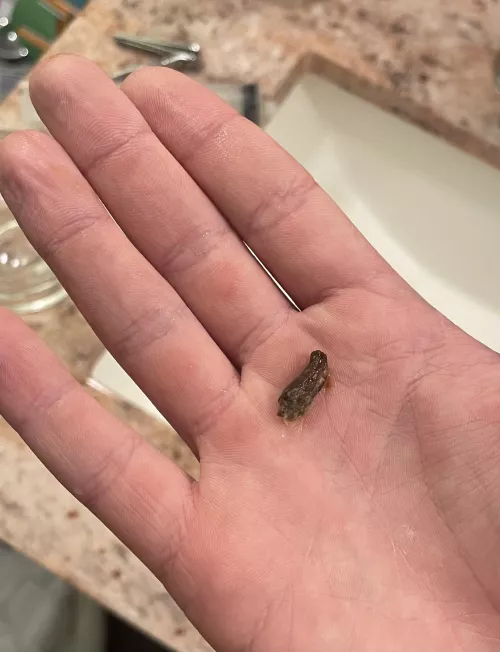 Woke up and I couldn’t hear, water irrigation got this out of my ear! by rizzarsh