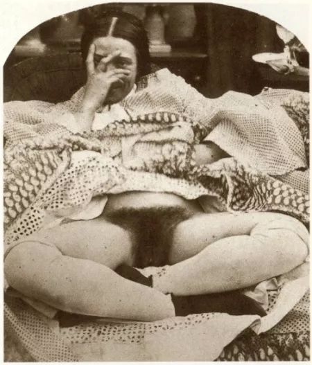 Woman with hairy genitalia in an anonymous daguerreotype, c. 1860. [ x-post /r/VictorianErotica/ ] by Lady-Hairy-Beaver