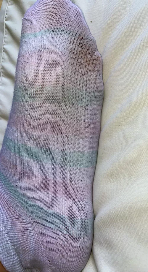 Worn for 2 days by missfeetandfingers