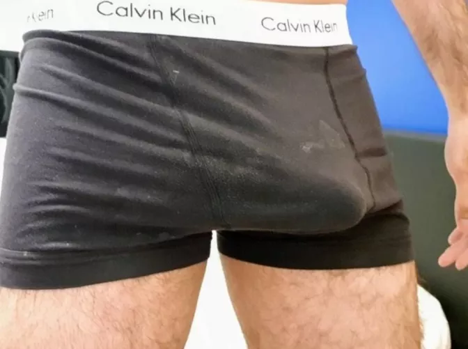 Yes they are white stains.. by Jaysusedsocks