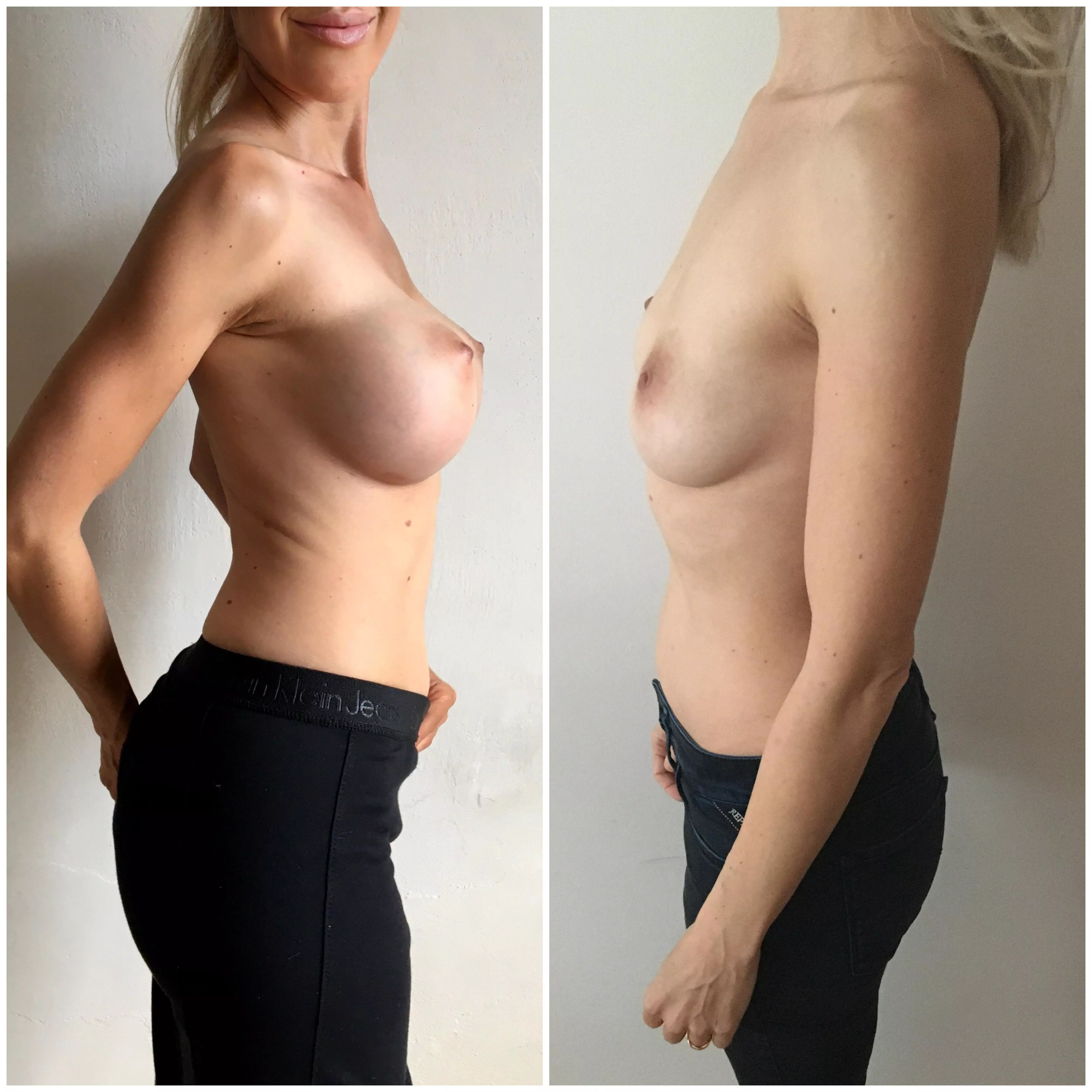 You have to understand - breast enlargement is for us women the same spiritual matter as if your penis were to go down and never up... :/ posted by jasmins_lounge